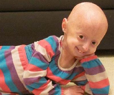 Adalia Rose - Trivia, Family, Bio