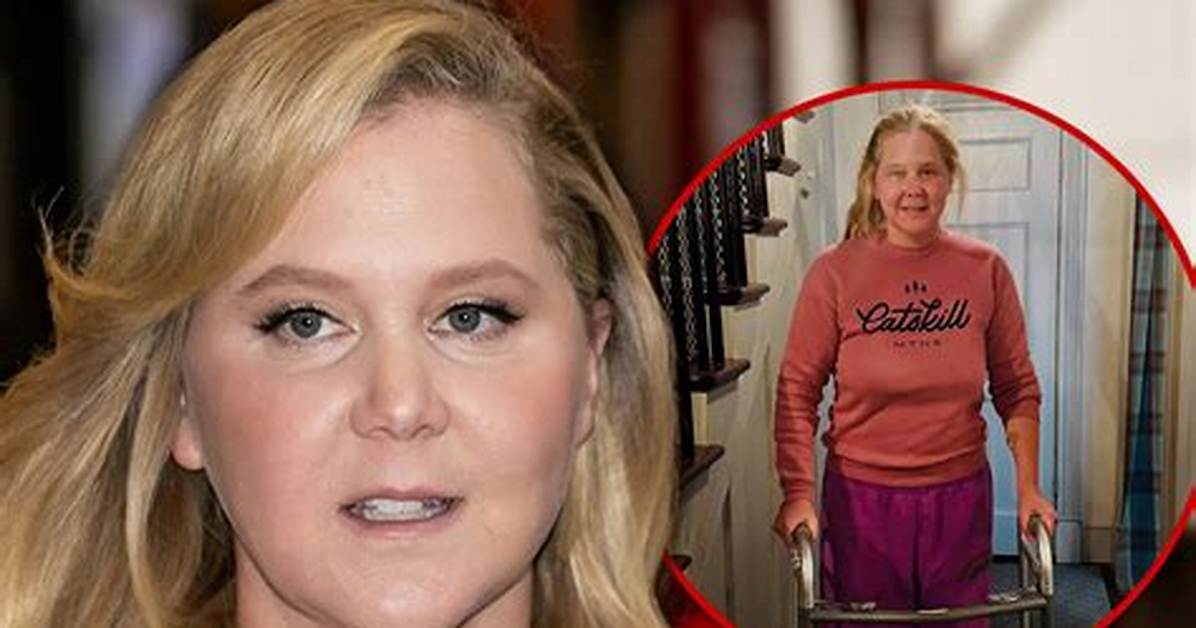 Amy Schumer Is Back at Work and Handling Trolls Like a Champ