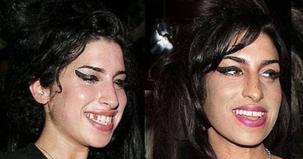 Amy Winehouse Gets Teeth Fixed, Some Advice from Keith Richards