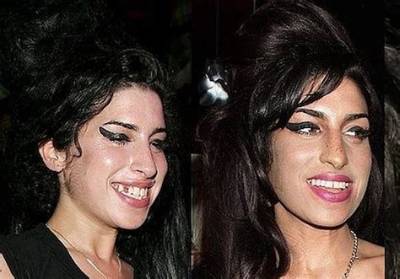 Amy Winehouse Gets Teeth Fixed, Some Advice from Keith Richards
