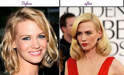 Apryl Jones Plastic Surgery | Botox Nose Job and Facelift