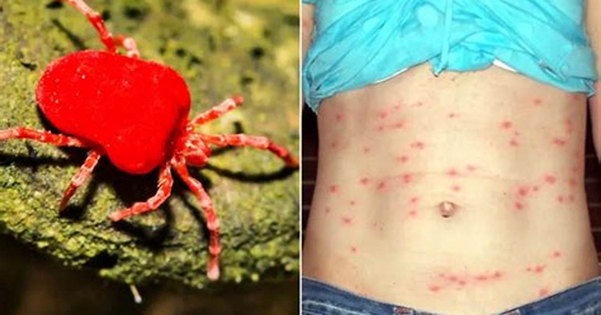 Are There Chiggers in Hawaii?