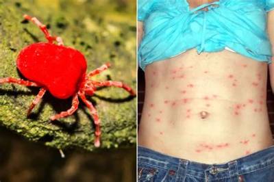 Are There Chiggers in Hawaii?