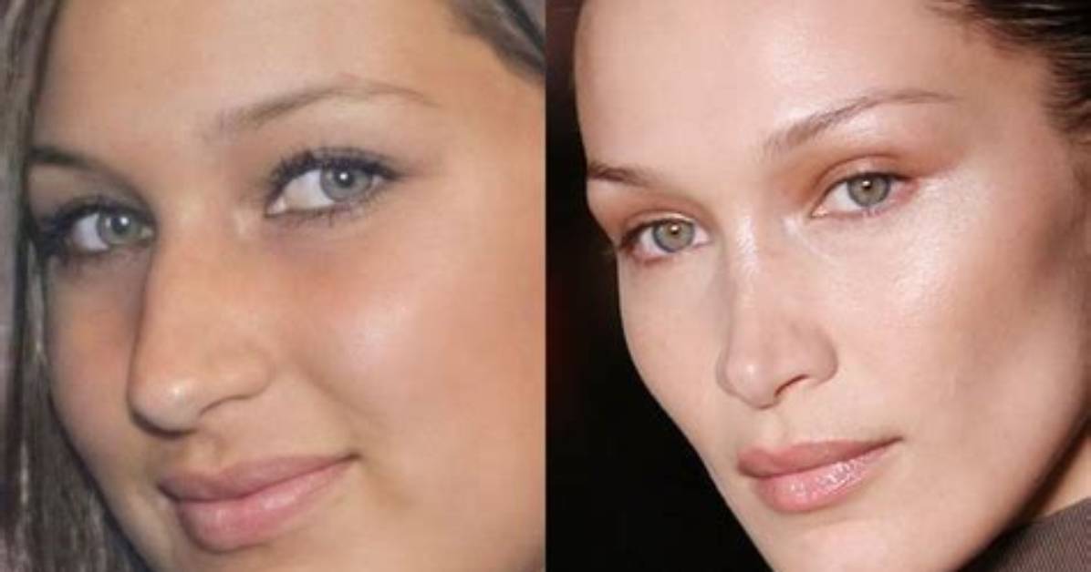 Bella Hadid Regrets Her Nose Job: ‘I Wish I Had Kept the Nose of My Ancestors’