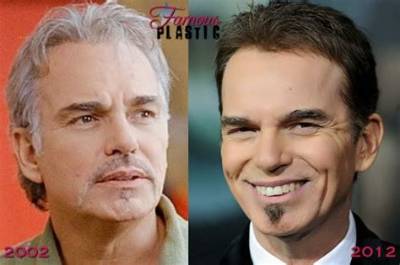 Billy Bob Thornton’s Botox Face Is Amazing, He’s Making a Movie About Angelina