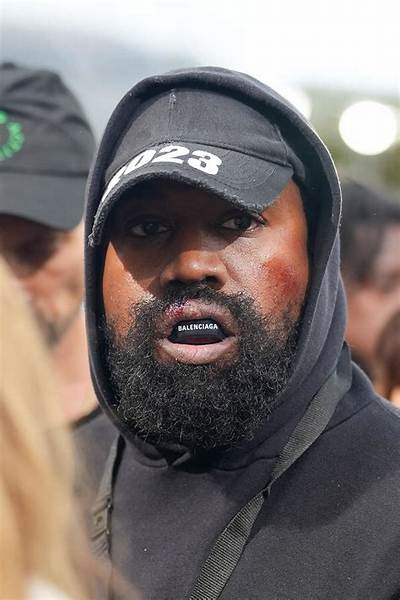 Bitchy | Kanye West Sports Busted Lip and Bruises as He Arrives to the Givenchy Show Duringg Paris Fashion Week – Womenswear Spring/Summer 2023