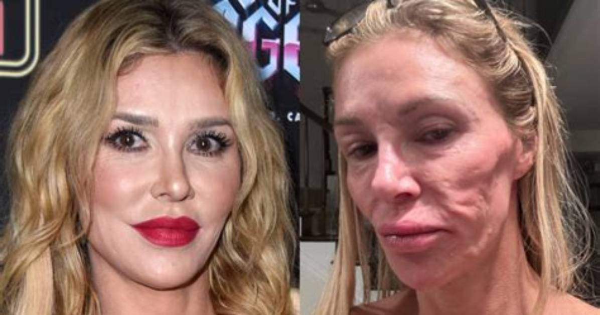 Brandi Glanville Explains Why She Came Back to ‘Rhobh’ After Being Fired: ‘Money’