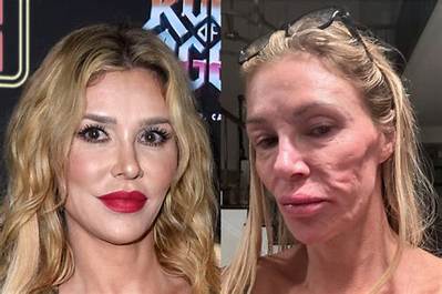 Brandi Glanville Explains Why She Came Back to ‘Rhobh’ After Being Fired: ‘Money’