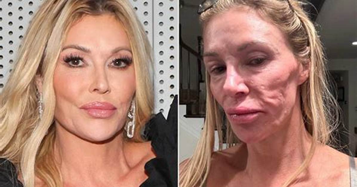 Brandi Glanville: ‘It’s Hard to Grow Older, Especially in This Town. I’ll Cop to Botox, Fillers’