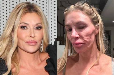 Brandi Glanville: ‘It’s Hard to Grow Older, Especially in This Town. I’ll Cop to Botox, Fillers’