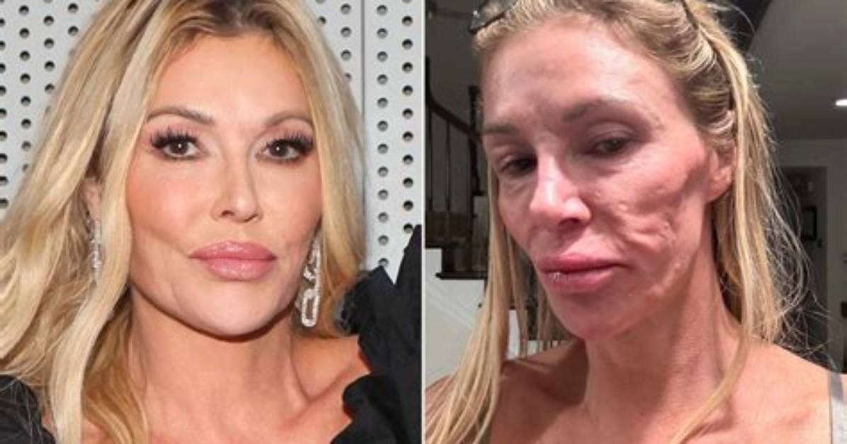 Brandi Glanville Under Fire for Relationship with Kim Richards