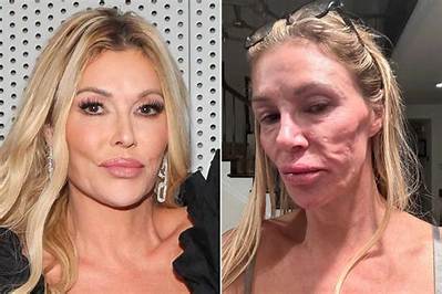 Brandi Glanville Under Fire for Relationship with Kim Richards