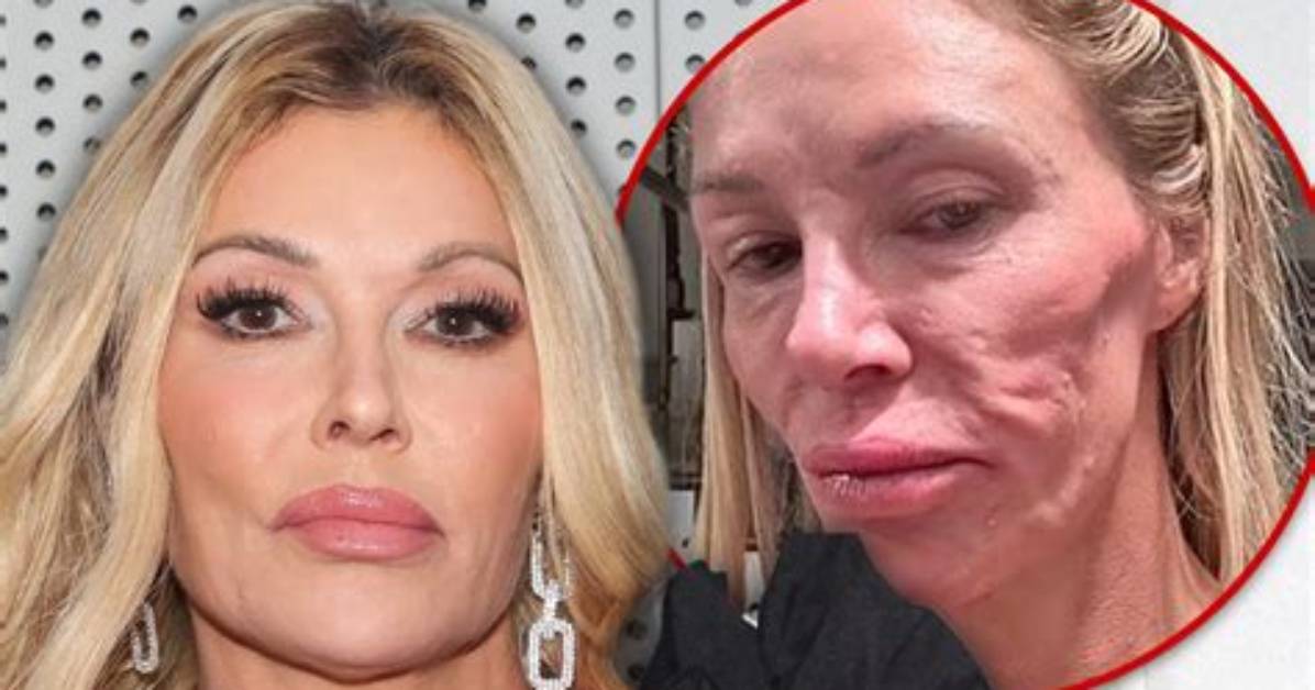 Brandi Glanville Will Probably Be Promoted to Full-Time Cast Member on ‘Rhobh’