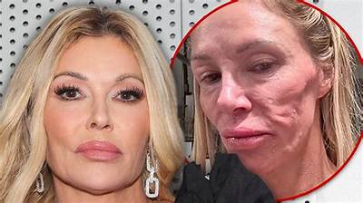 Brandi Glanville Will Probably Be Promoted to Full-Time Cast Member on ‘Rhobh’