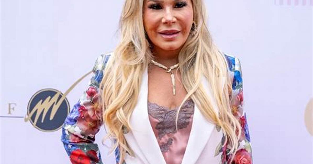 Bruised Photos of Rhobh’s Adrienne Maloof Released: ‘Beaten. He Is a Beast’
