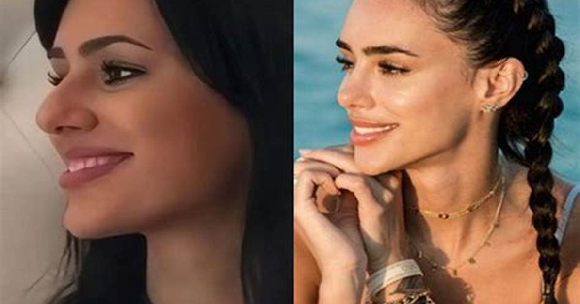 Bruna Biancardi Plastic Surgery Viral on Tiktok | Before and After Photo