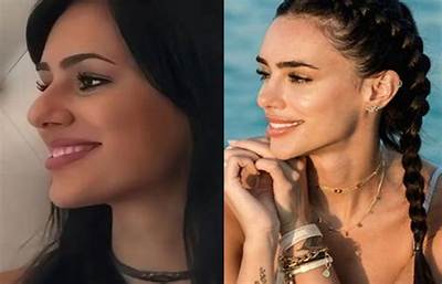 Bruna Biancardi Plastic Surgery Viral on Tiktok | Before and After Photo