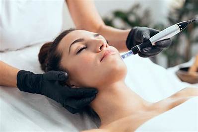Can Estheticians Microneedle?