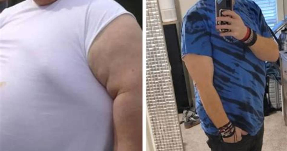 Casey King’s Amazing Weight Loss Journey from 845 Lbs to 266 Lbs!