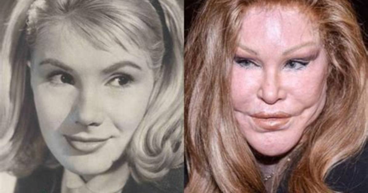 Cat Woman Plastic Surgery: Flashback to Her Youth-a Glance at Her Childhood Beauty!