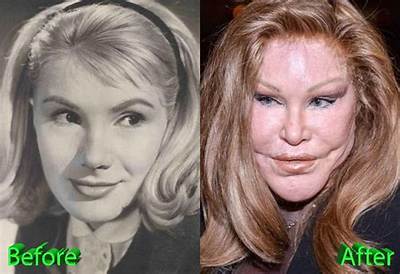 Cat Woman Plastic Surgery: Flashback to Her Youth-a Glance at Her Childhood Beauty!