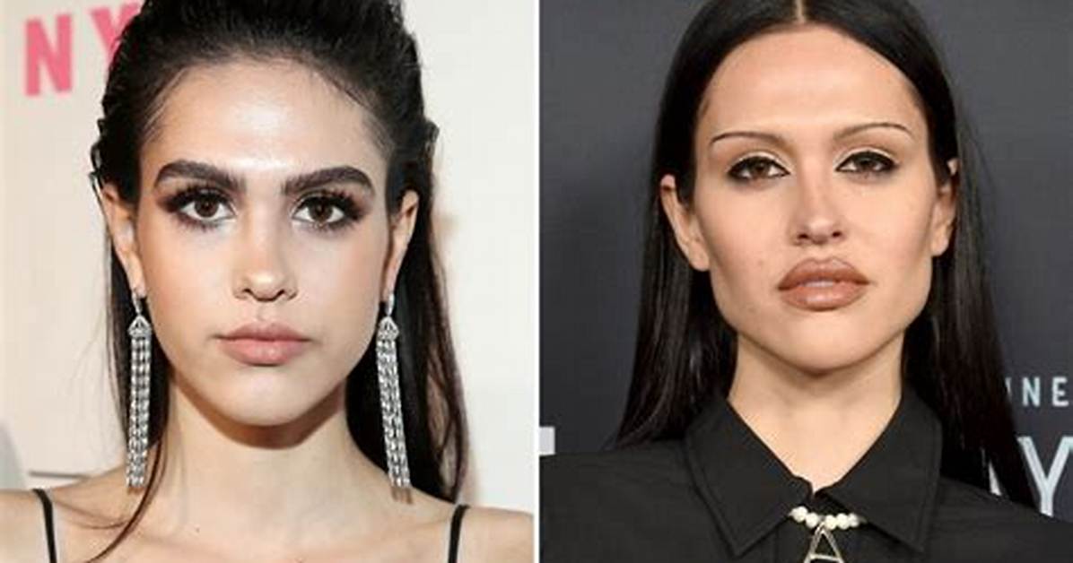 Celebrities Unrecognizable After Plastic Surgery