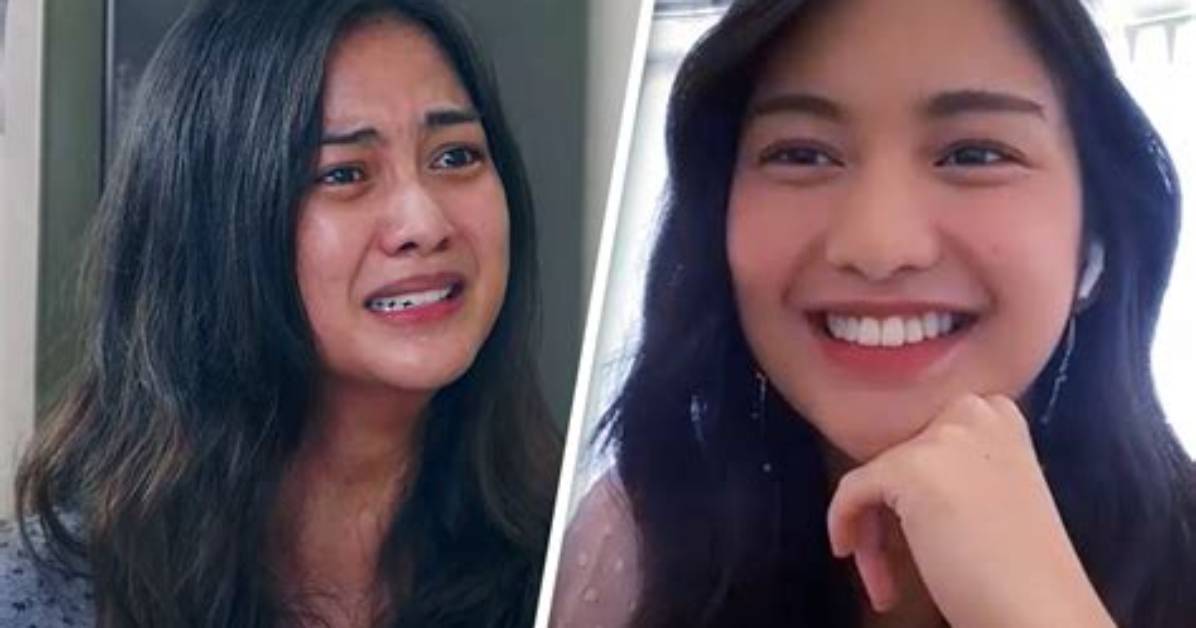 Charlie Dizon Before Surgery | Filipino Actress Plastic Surgery Transformation