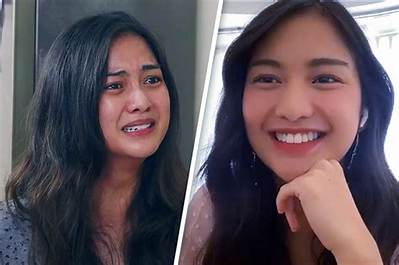 Charlie Dizon Before Surgery | Filipino Actress Plastic Surgery Transformation
