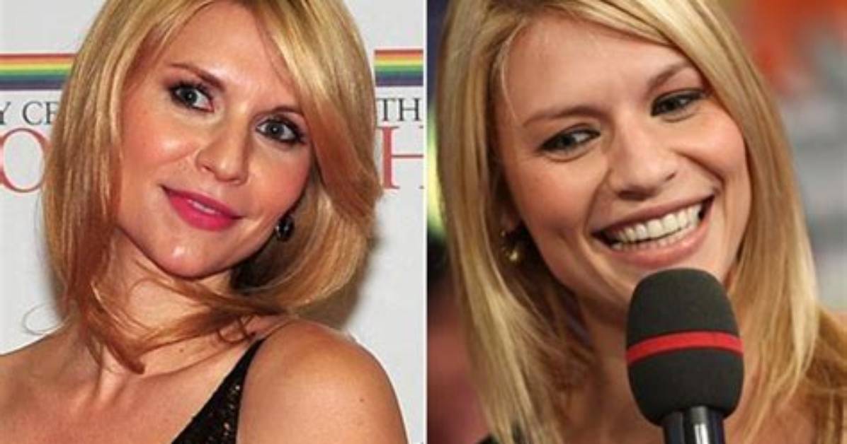 Claire Danes on Plastic Surgery: “I Don’t Think Anyone Should Judge Anyone”