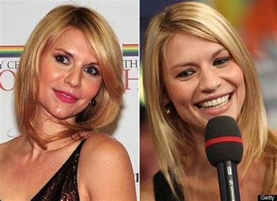 Claire Danes on Plastic Surgery: “I Don’t Think Anyone Should Judge Anyone”