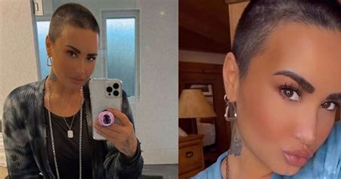 Demi Lovato Cut Their Head on a Giant Crystal and Needed Stitches