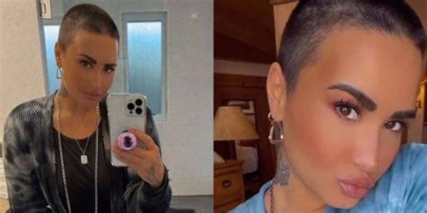 Demi Lovato Cut Their Head on a Giant Crystal and Needed Stitches