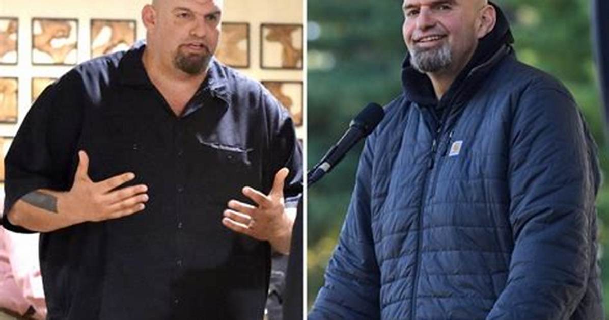 Did John Fetterman Get a Plastic Surgery? Us Senator’s Pictures After Clinical Depression Treatment Go Viral