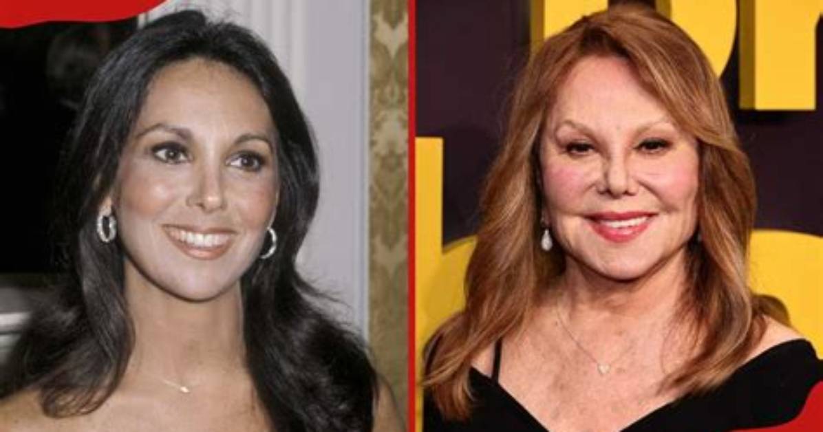 Did Marlo Thomas Undergo Face Surgery? Before and After Photos on Ig