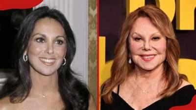 Did Marlo Thomas Undergo Face Surgery? Before and After Photos on Ig