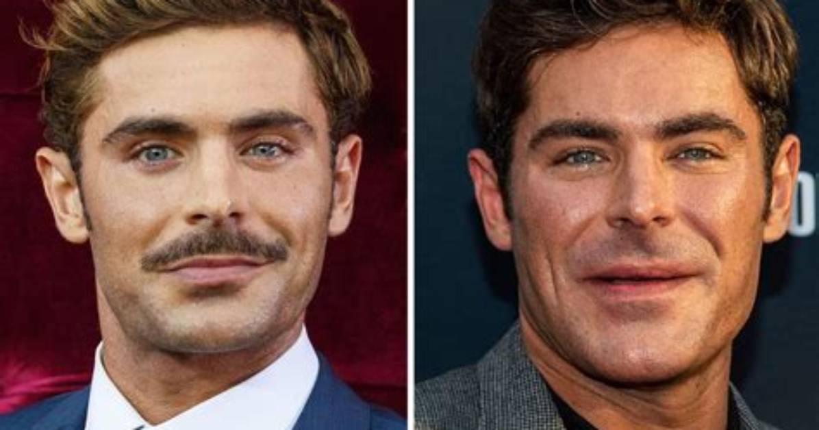 Did Zac Efron Get a Jaw Job Done? Actors Sets the Record Straight