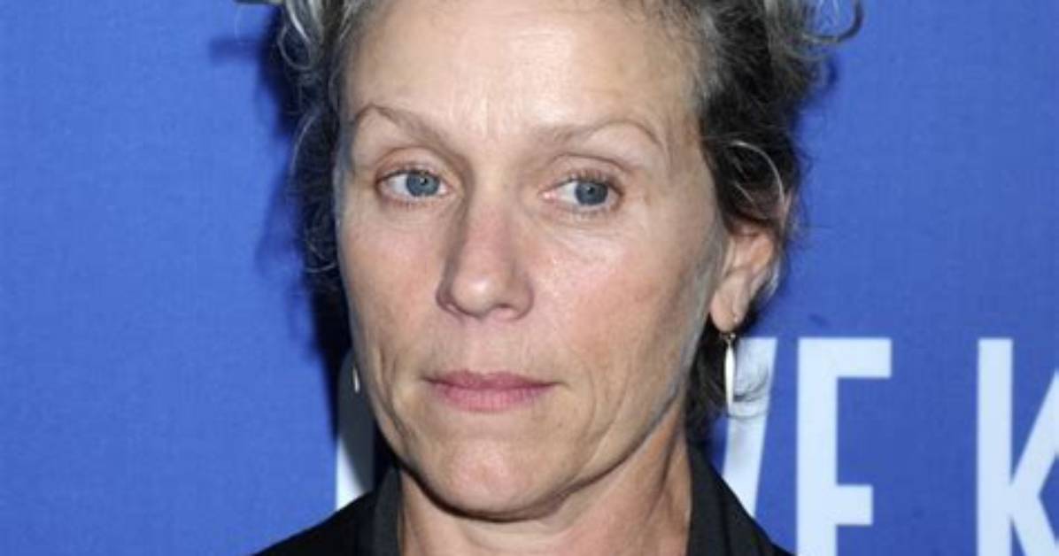 Frances Mcdormand: Botox & Plastic Surgery Erase the ‘Roadmap’ of Life