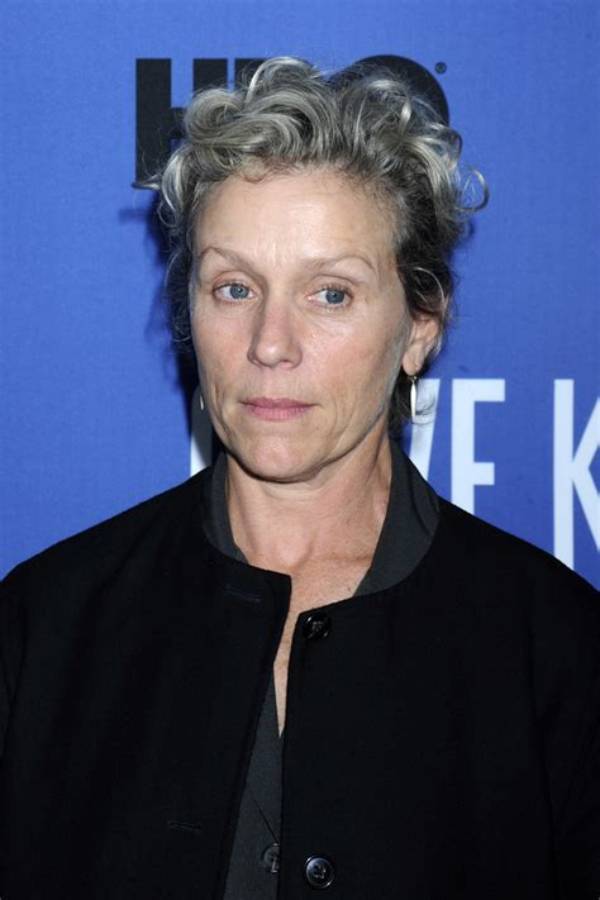 Frances Mcdormand: Botox & Plastic Surgery Erase the ‘Roadmap’ of Life
