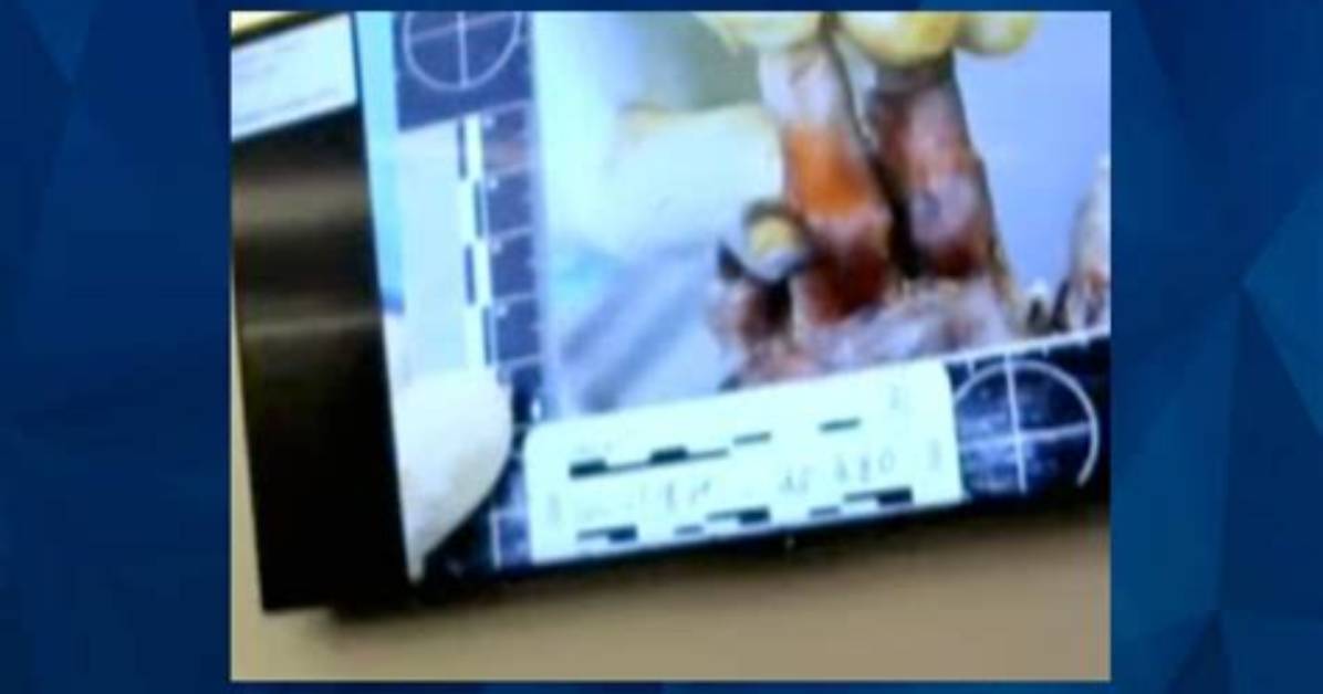 Gannon Stauch Suitcase Photos and Autopsy Report Update, Cause of Death Explained
