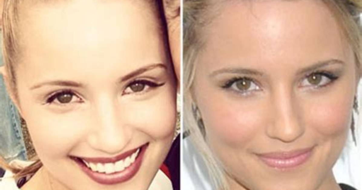 Glee’s Dianna Agron Explains Nose Job: I Got Punched in the Nose Twice