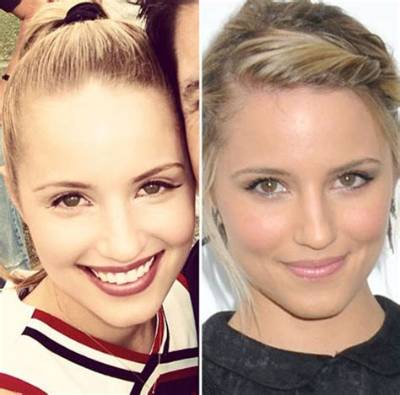 Glee’s Dianna Agron Explains Nose Job: I Got Punched in the Nose Twice