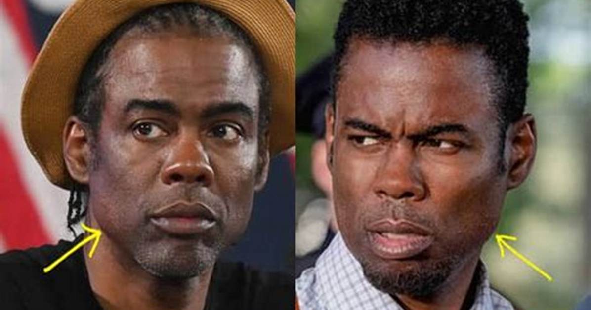 Has Chris Rock Had a Facelift with Botox and a Nose Job? Everything You Need to Know