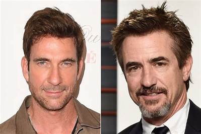 Has Dylan Mcdermott Done Plastic Surgery? Jaw Lift Rumors Debunked!