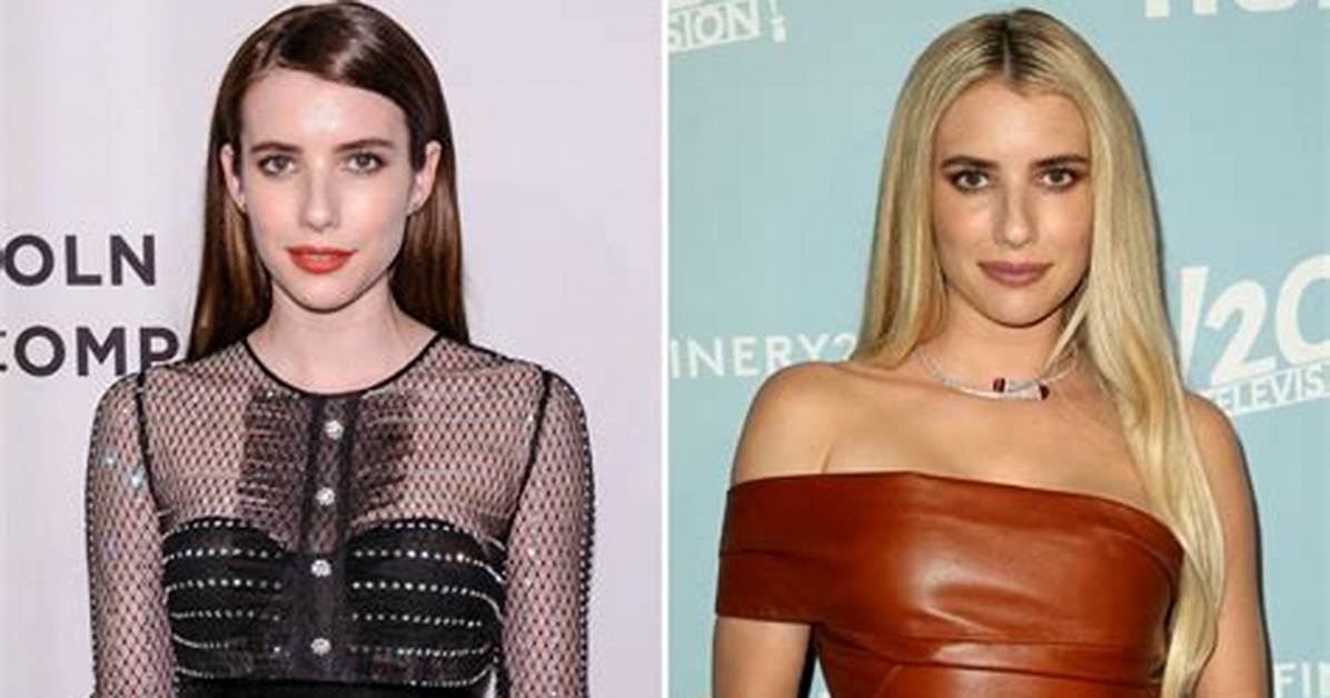 Has Emma Roberts Done Plastic Surgery? Fans Are Curious If She Had Lip Filler and Botox
