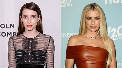 Has Emma Roberts Done Plastic Surgery? Fans Are Curious If She Had Lip Filler and Botox