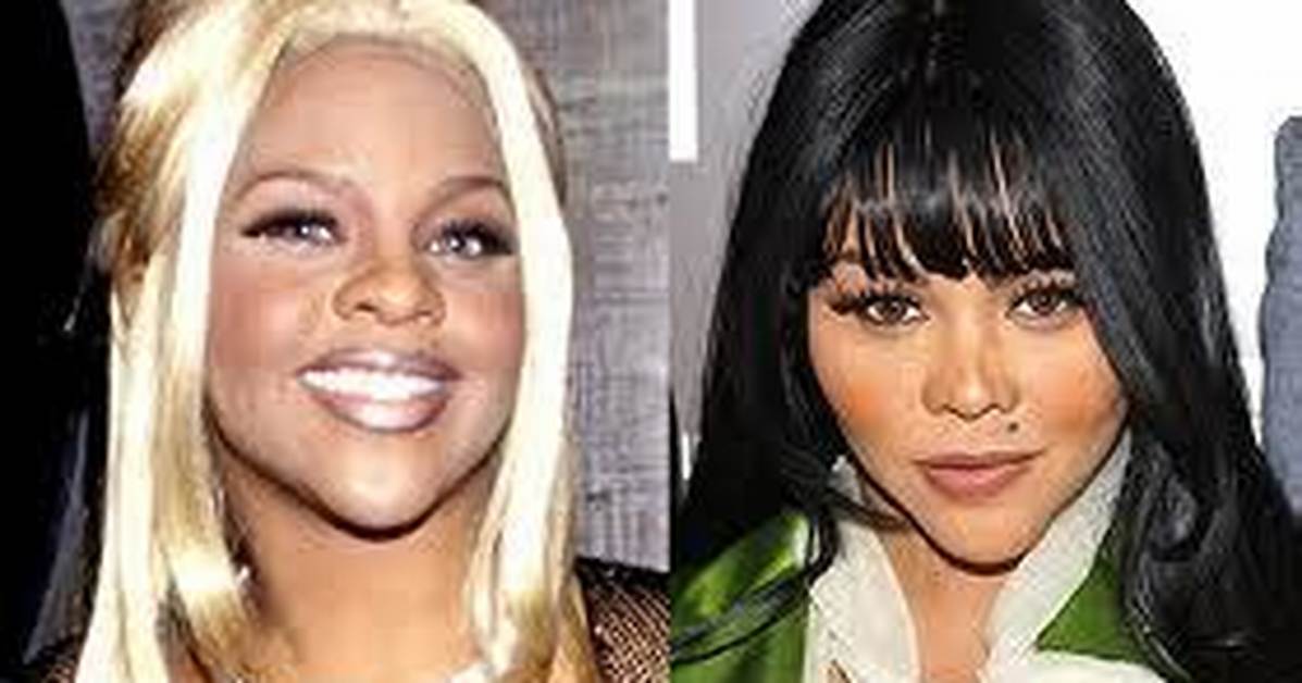 Has Lil Kim Done Botox and Lip Fillers? Her Before and After Photos