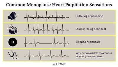 Heart Palpitations Are a Symptom of Perimenopause, Even Oprah’s Docs Didn’t Know