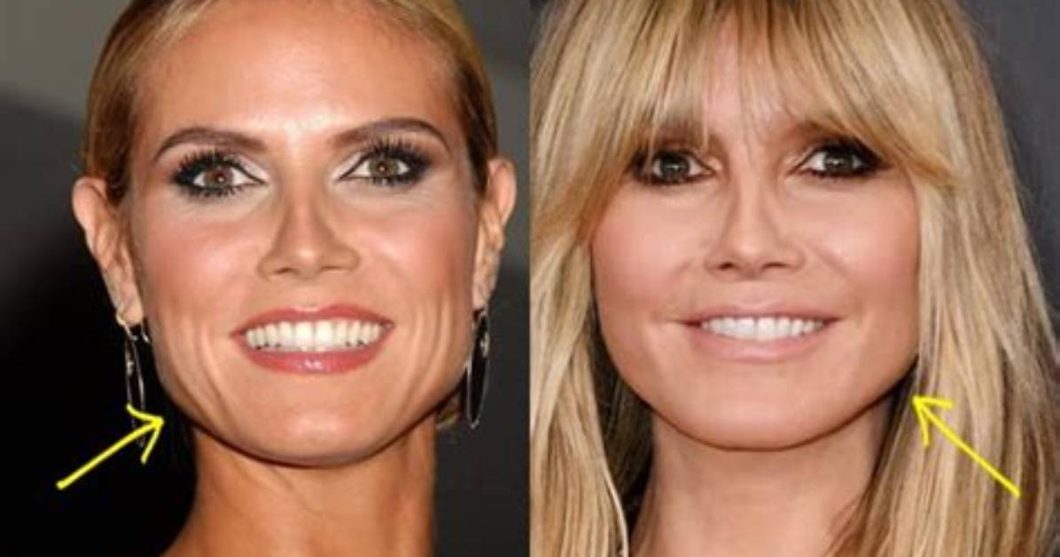Heidi Klum: Plastic Surgery “Doesn’t Look Pretty, Especially on Young Girls”