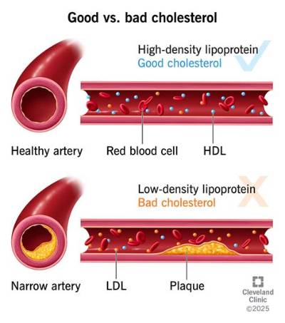 How Much Cholesterol Is in a Can of Tuna?