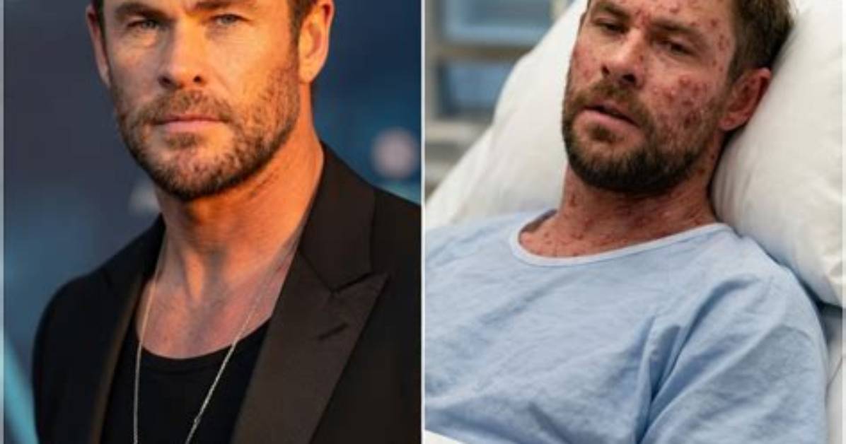 Is Chris Hemsworth Sick? Illness Health Update and Family